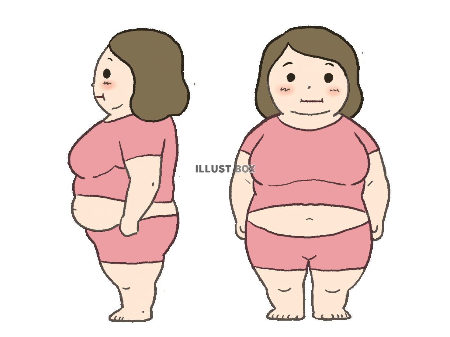 肥満女性