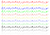音符　帯Ａ（五線譜なし）単色　【透過PNG】