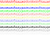 音符　帯Ｂ（五線譜あり）単色　【透過PNG】