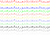 音符　帯Ｂ（五線譜なし）単色　【透過PNG】