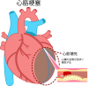 心臓の病気(png・CSeps）