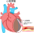 心臓の病気(png・CSeps）
