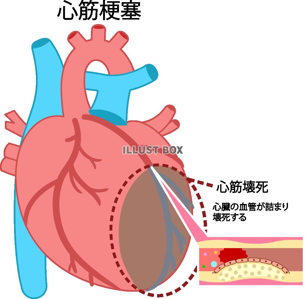 心臓 イラスト無料