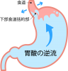 胃酸の逆流(png・CSeps）