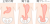 胃下垂・胃アトニー(png・CSeps）