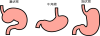 胃の種類(png・CSeps）