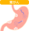 胃癌(png・CSeps）