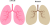 正常・異常の肺(png・CSeps）
