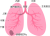 肺がん(png・CSeps）