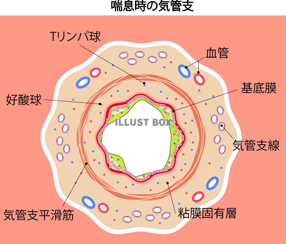 無料イラスト 喘息時の気管支 Png Cseps