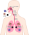 気管支炎(png・CSeps）