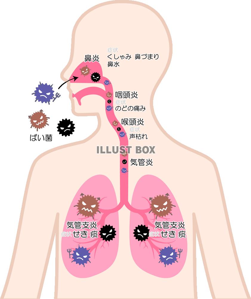 気管支炎 イラスト無料