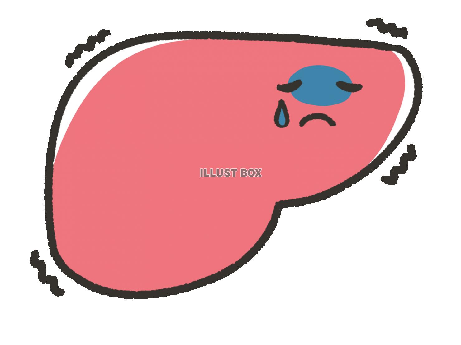 無料イラスト 手描きの不健康な肝臓