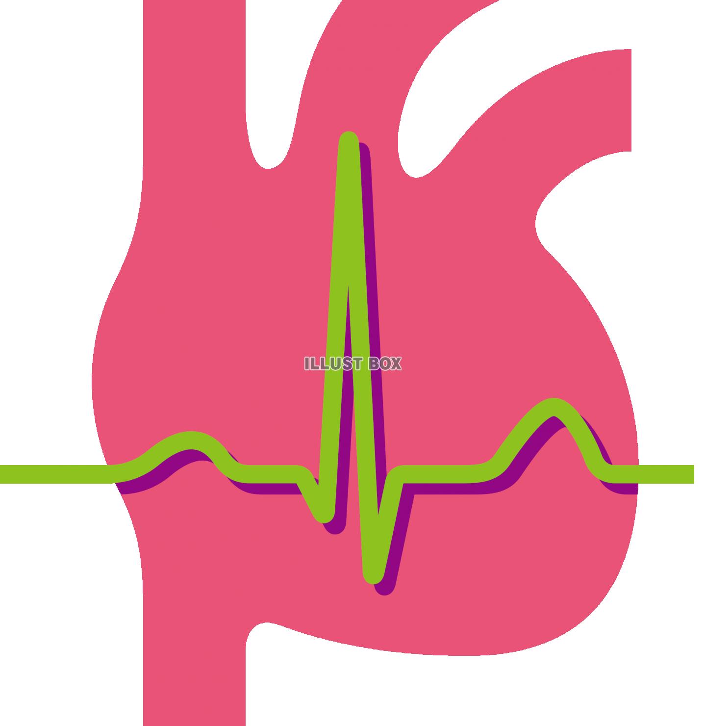 心電図 イラスト無料