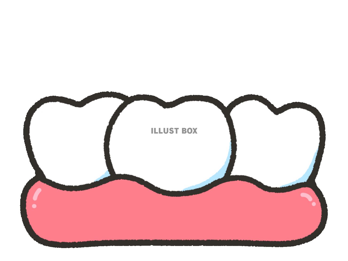 歯並び イラスト無料