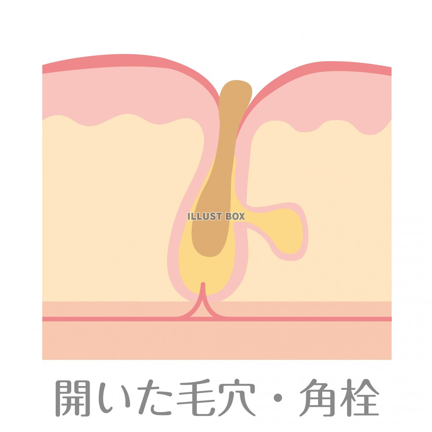 肌の構造★開いた毛穴・角栓★ニキビ