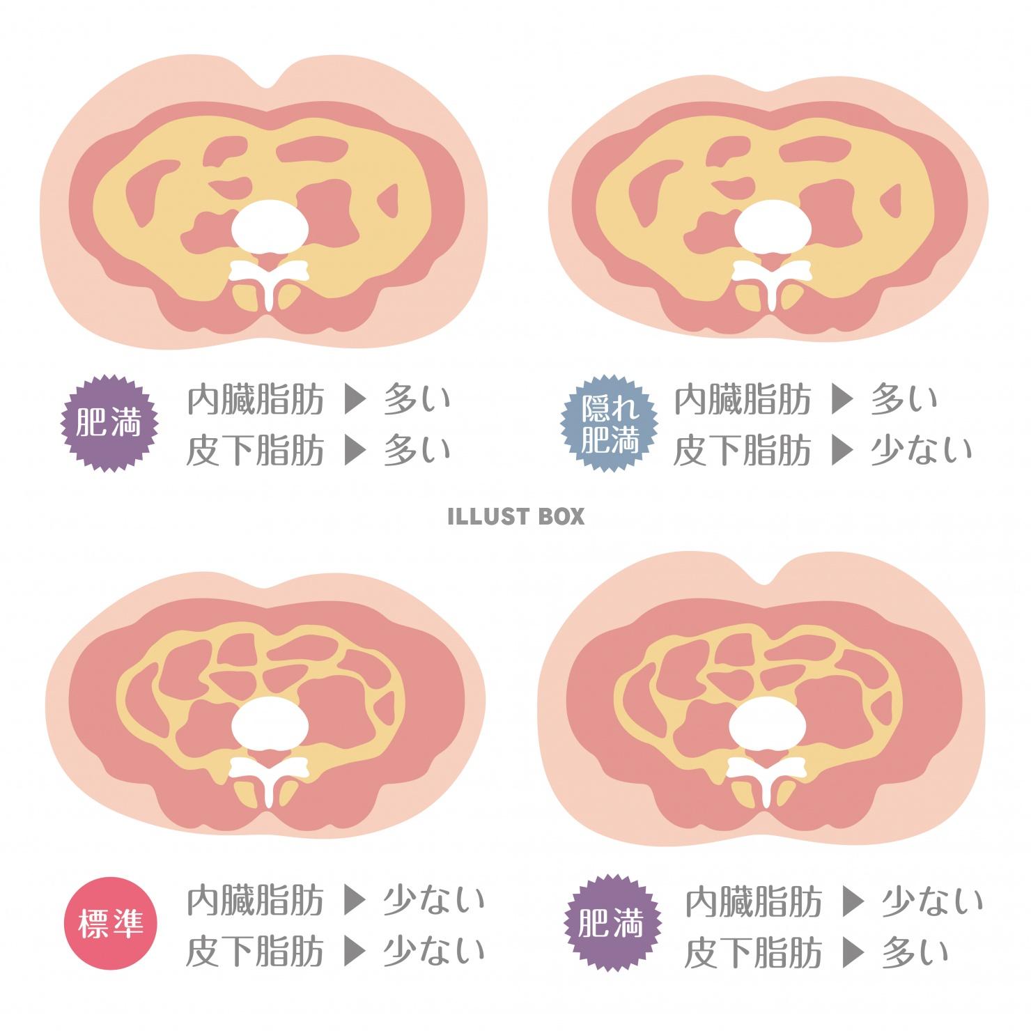 肥満のタイプ★皮下脂肪と内臓脂肪