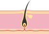 髪　毛根　頭皮　断面図