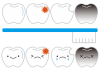 9_イラスト_歯8種・無地・顔付き・歯ブラシ