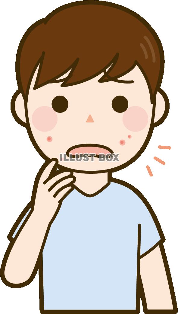 肌荒れしている男性