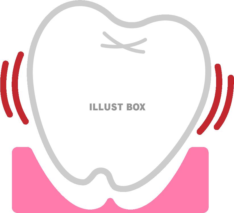 グラグラしている歯