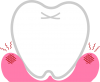 歯茎が腫れている歯