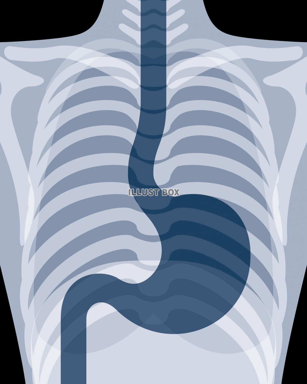 レントゲン写真風の胃　医療・健康・メディカル