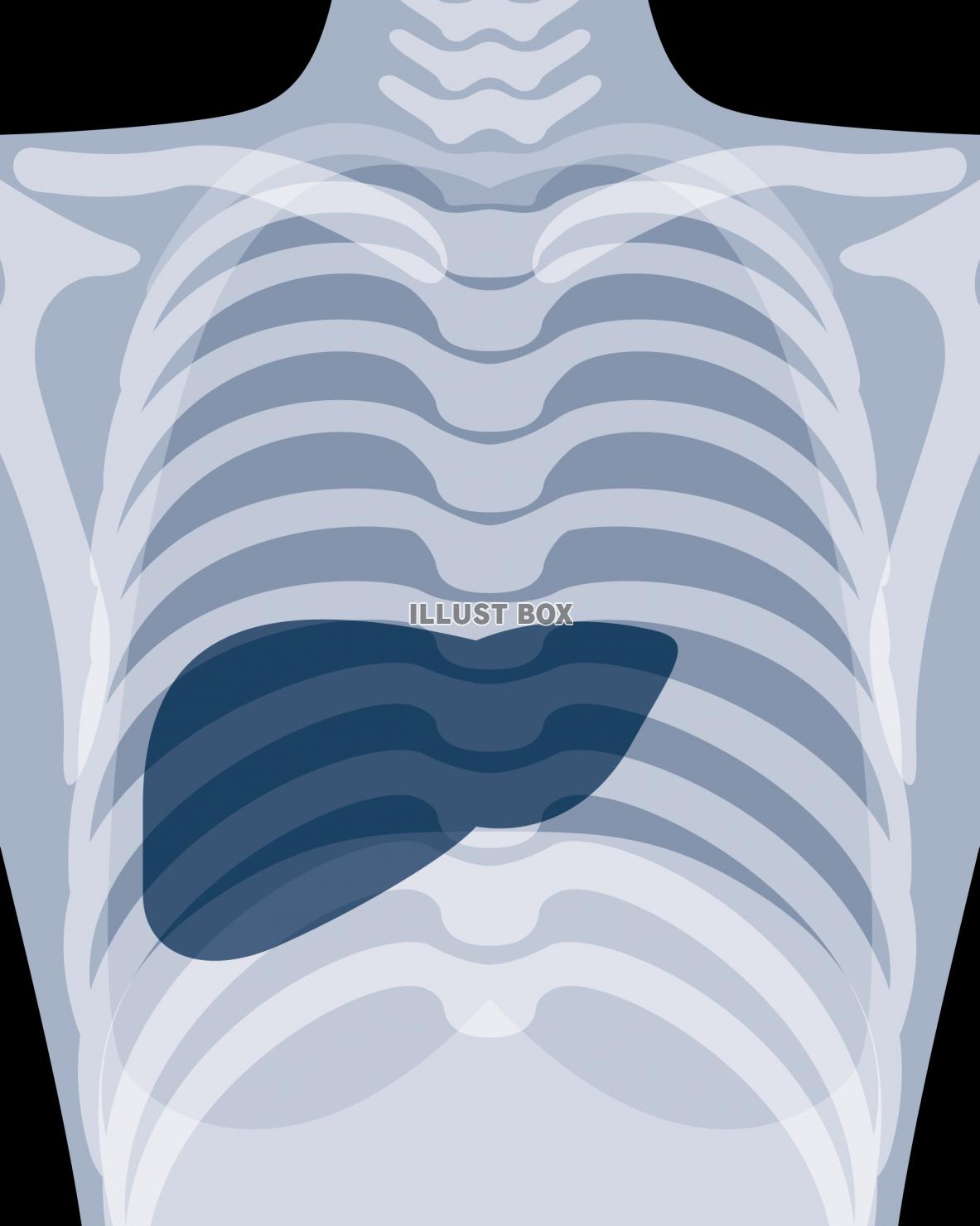 レントゲン写真風の肝臓　医療・健康・メディカル