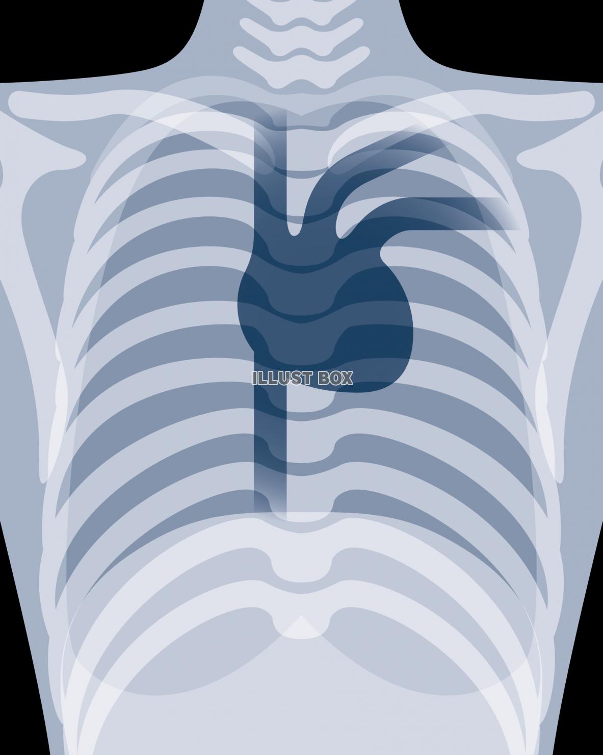 レントゲン写真風の心臓　医療・健康・メディカル