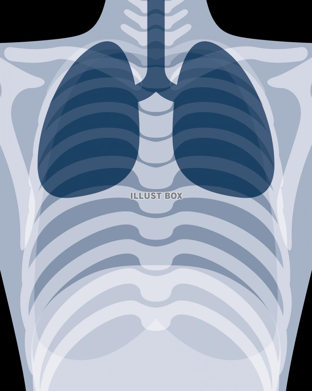 レントゲン写真風の肺　医療・健康・メディカル