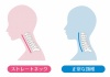 人間の身体★首★正常な頚椎とストレートネック★スマホ首