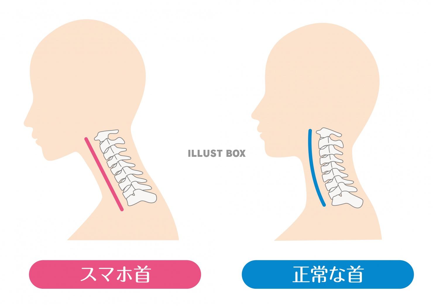 人間の身体★首★正常な頚椎とストレートネック★スマホ首