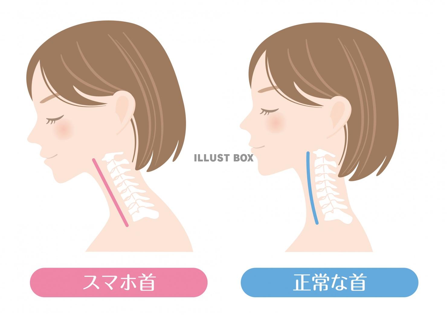 人間の身体★首★正常な首とスマホ首★ストレートネック