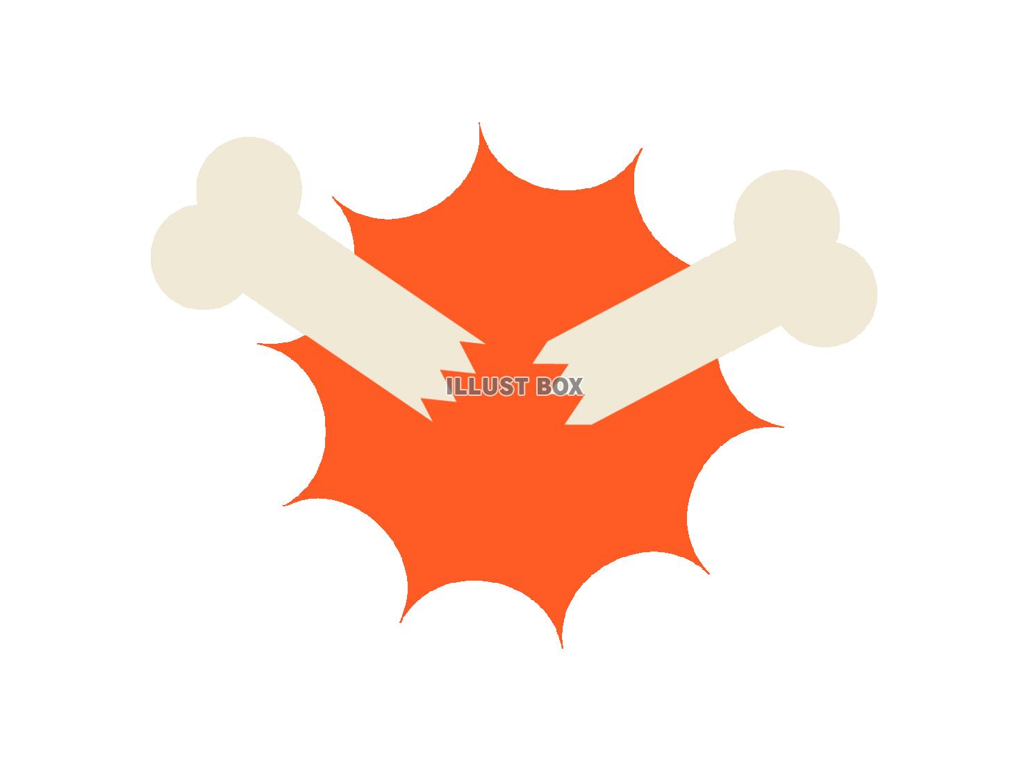 脱Xilantおよび避妊