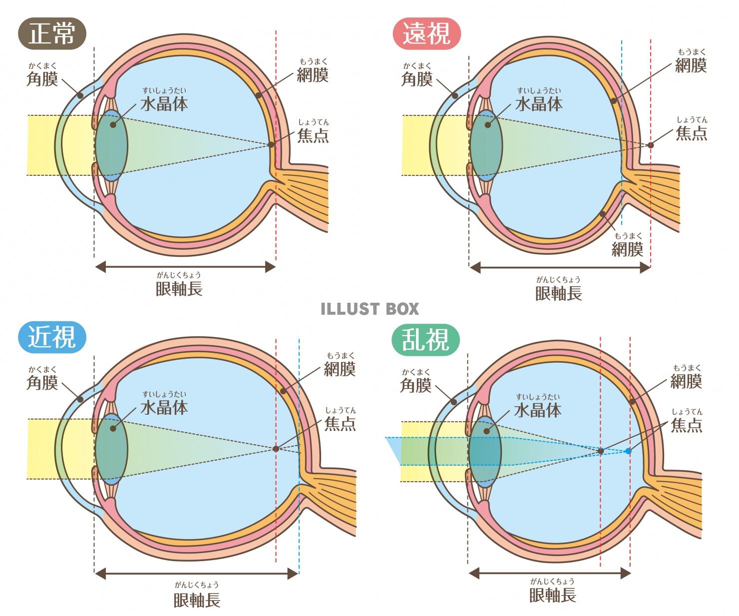 人間の身体★目の構造★近視・遠視・乱視★文字あり