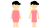女性　エステ　美容　ビフォーアフター